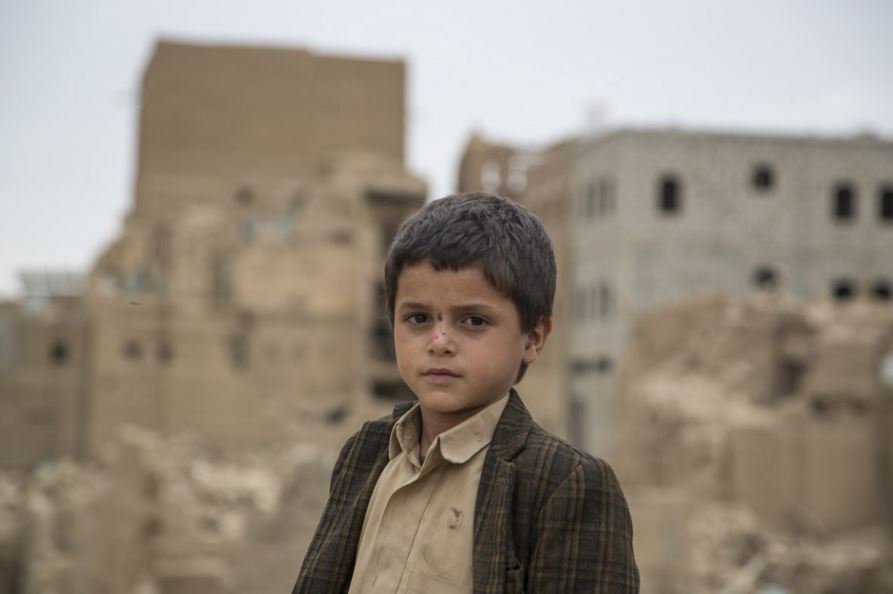 WFP's tweet photo. #Yemen is on the brink of famine. 18 million people don’t know where their next meal is coming from. Children suffer the most. Their stories → https://t.co/xvWlGW9BLy https://t.co/YjiMuFBQ0W