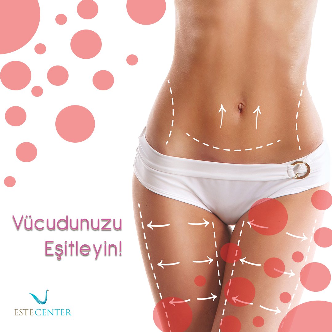 estecenter's tweet photo. Vücudun fazla yağ üretimi ardından da vücut şekline göre belirli bölgelerde toplanmasına bir dur demek sizin elinizde. #estecenter #plastikcerrahi #kadin #yagaldirma #estetik https://t.co/f5PkcObhHU