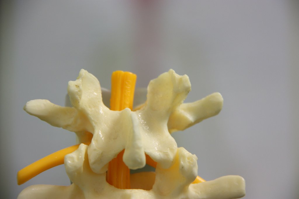 InsightImed's tweet photo. #Spinal #Brucellosis was a kind of #spineinfection that occurred in the #spinaljoint space or the surrounding #tissues of spine.The illness triggered #inflammation that present in #spinalintervertebral discs known as #BrucellarSpondylitis.For more vist https://t.co/k1VOFvLBjT https://t.co/POGLLAd5wZ