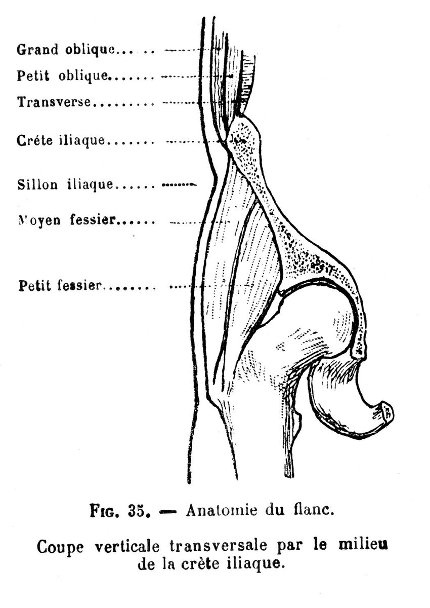 腰あたりの冠状(前頭)断の性差。1枚目:男性、2枚目:女性。腸骨稜の外側やや下方が窪むのと、腰部の皮下脂肪層の違いが観察できる。非常にレアな図だが、トリミングにセンスの差が現れることを教えてくれる。図示することは結構奥が深い。 