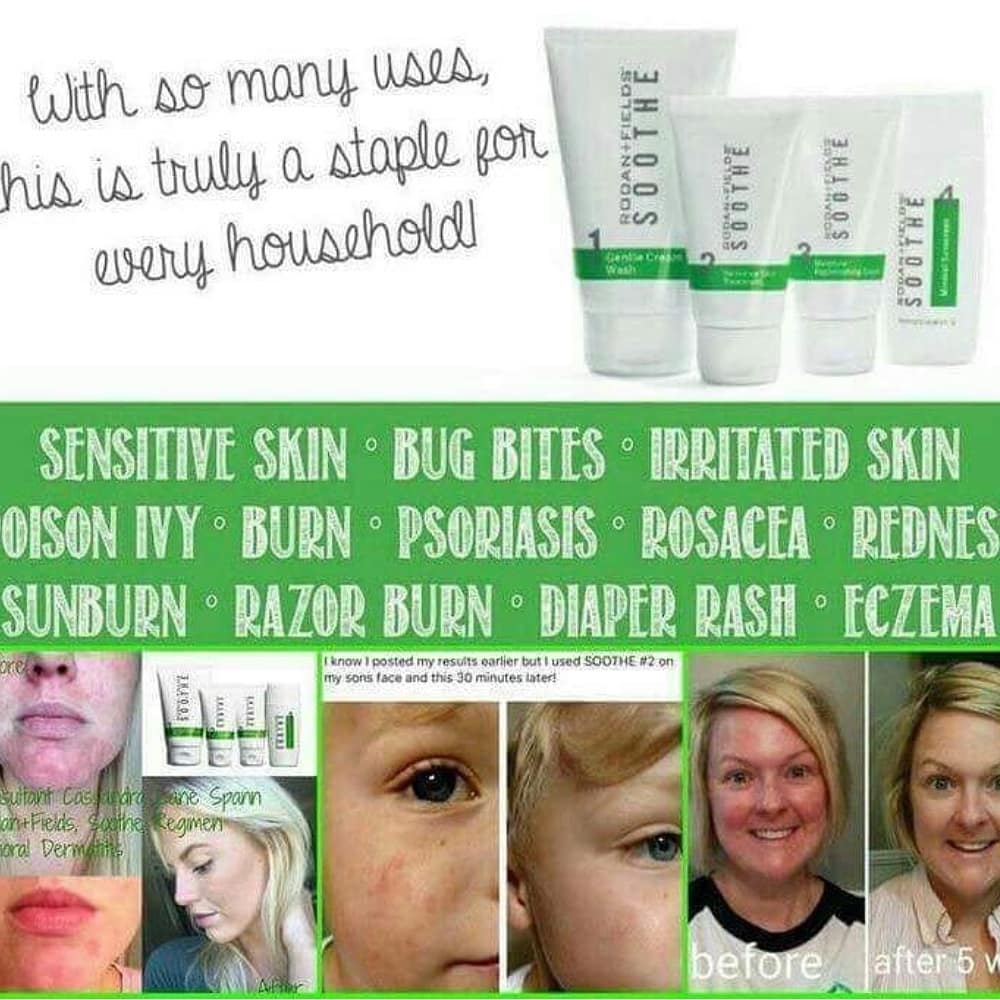KellyHands7's tweet photo. @KimKardashian Rodan+Fields SOOTHE regimen can help treat sensitive skin. Great for all ages Kim
https://t.co/73ddaPTqPR https://t.co/yoAGKMdL6A