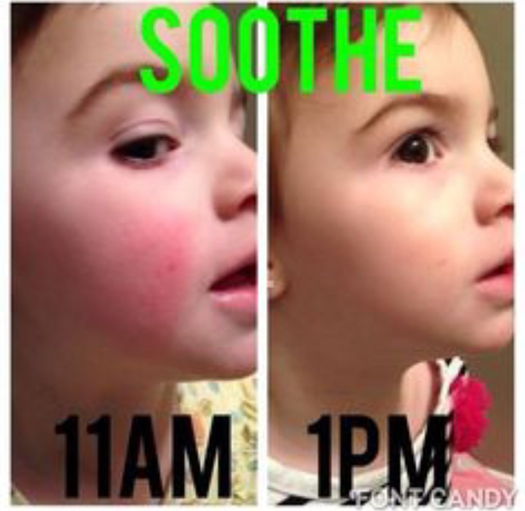 KellyHands7's tweet photo. @KimKardashian Rodan+Fields SOOTHE regimen can help treat sensitive skin. Great for all ages Kim
https://t.co/73ddaPTqPR https://t.co/yoAGKMdL6A