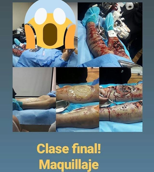 BELLEZAYCOLORCL's tweet photo. #simulacionheridas #fxmakeup #Makeup #MUA #muamariajesus #bellezaycolor #bodyart #bodypaint #bodyartist #byc #blood #halloween Nueva foto en Instagram https://t.co/C7U4C4OCNp