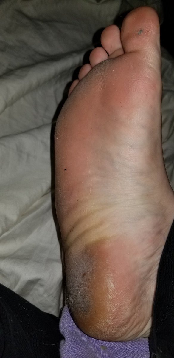 mistyweebz's tweet photo. My over 11 hour working #feet! 
So #dirty and ready for you to #cum all over! #feetfriday #dirtyfeet #findom #feetfetish #feetworship #cum #suckmytoes #toes #soles #sellsfeetpics #dom #sexy https://t.co/v50daLZuDF