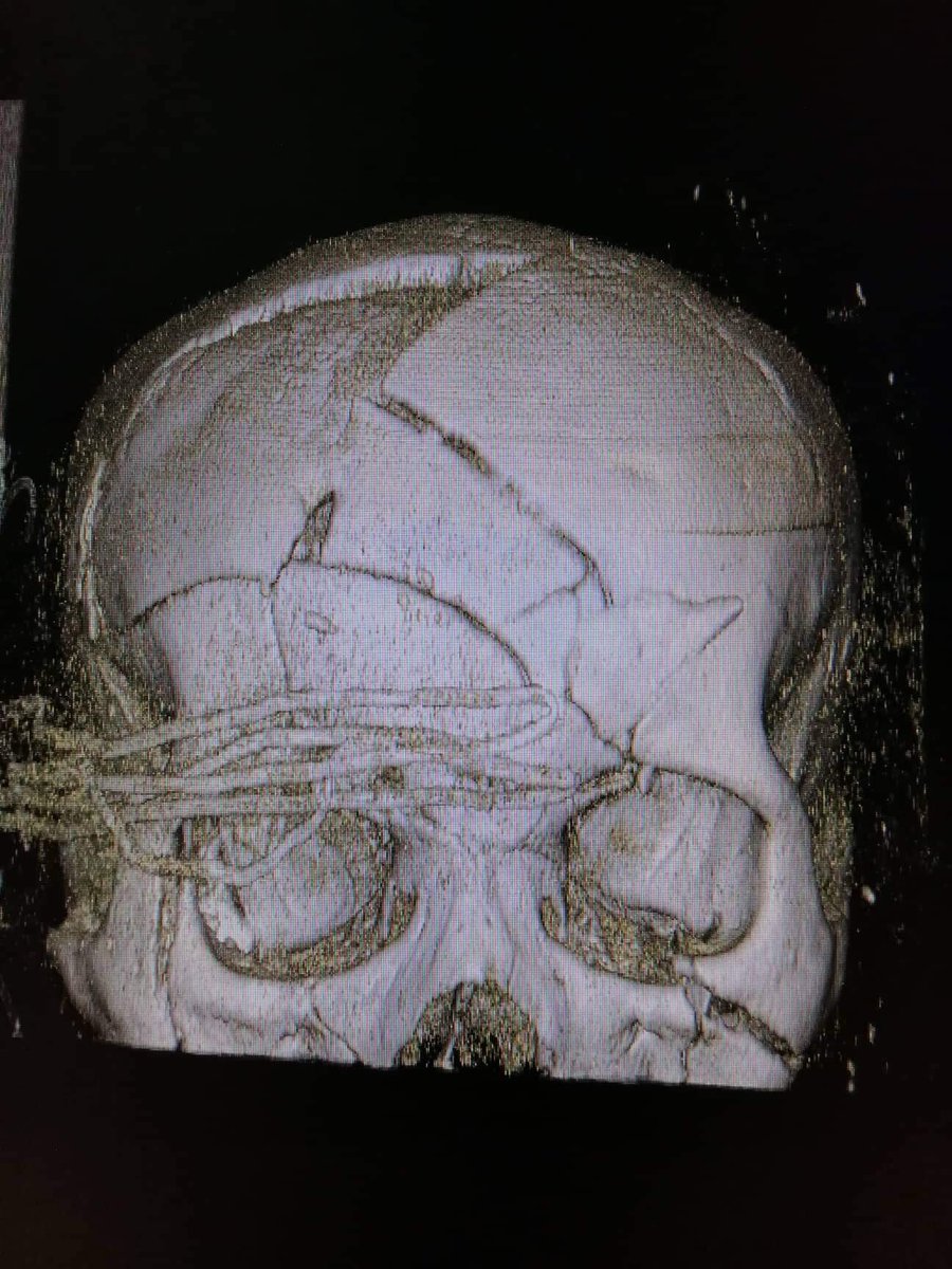darthdokki's tweet image. two years in the field, this just went to the top of my list

#ERTrauma