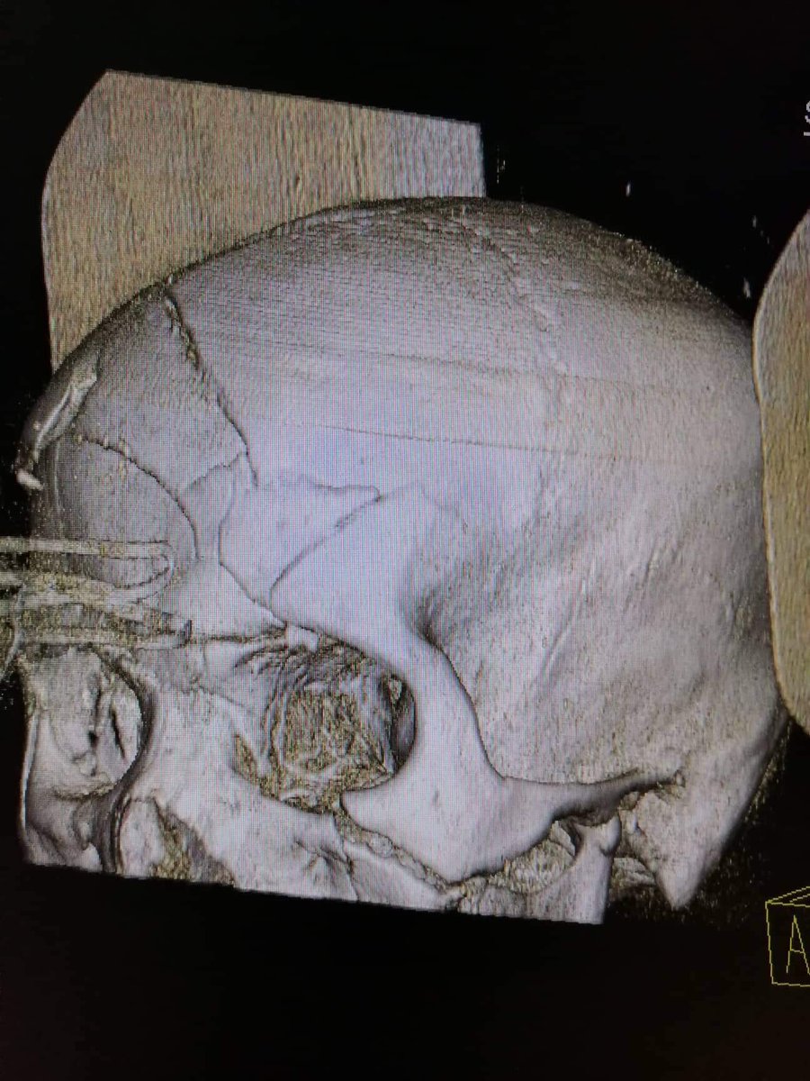 darthdokki's tweet image. two years in the field, this just went to the top of my list

#ERTrauma