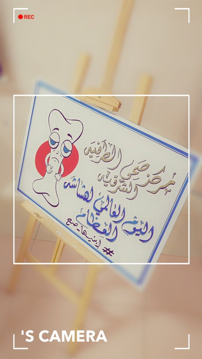 اختبار كثافة العظام Mayo Clinic مايو كلينك