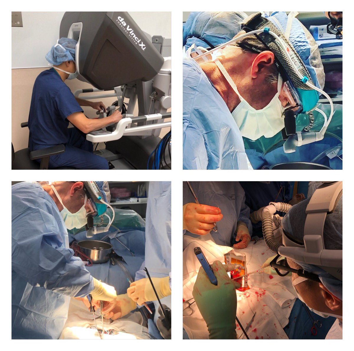 World Class Mitral Valve Care here in the South!  The Mitral Valve Program - Fort Worth!
#SundayMorning <a href="/askdrgonzo/">Dr. Gonzo Gonzalez</a>