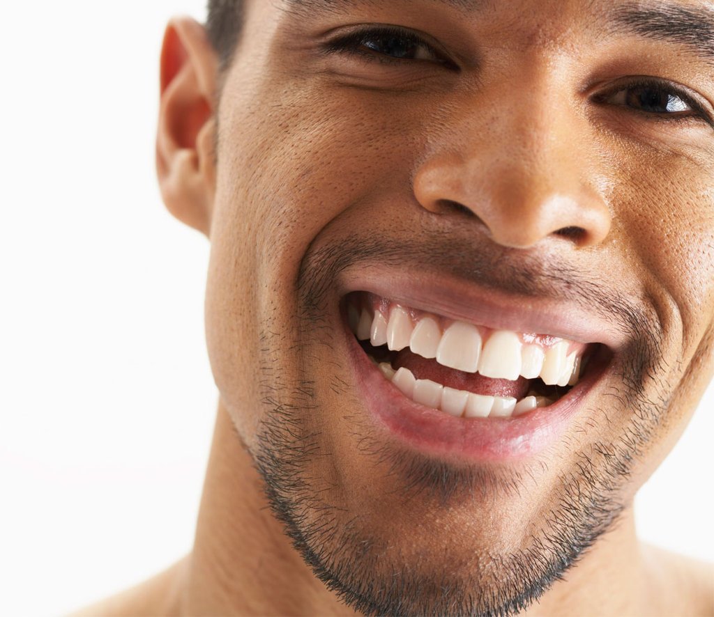 Malibu Teeth Whitening, Inc. #whiteteethfast. #teeth. 