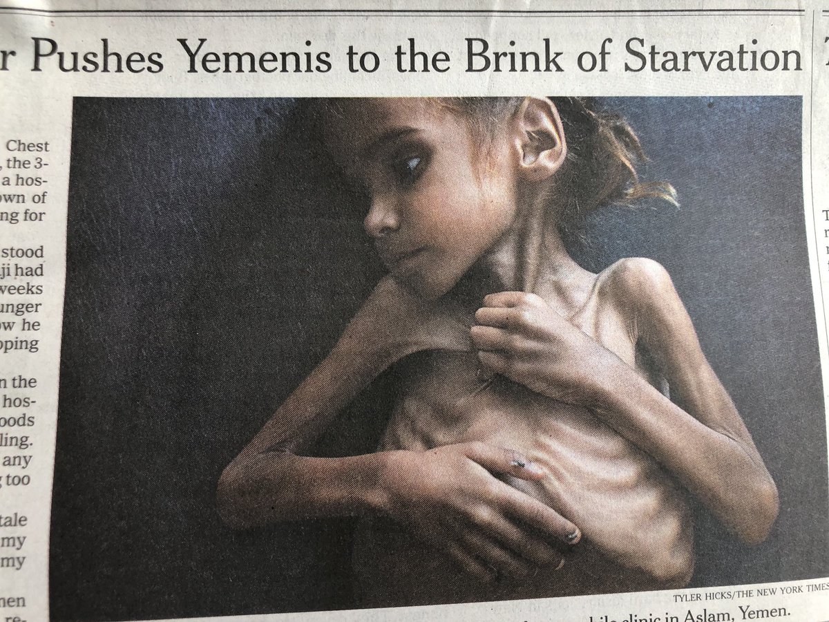 SenJeffMerkley's tweet photo. America is complicit. Stop Saudi arm sales.

Photo via @washingtonpost https://t.co/5wGjd4ts9T