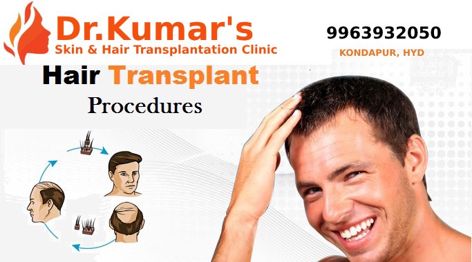 drashokkumar143's tweet image. HAIR TRANSPLANT PROCEDURES IN HYDERABAD
thehaircare.co.in
Hair transplant services better, permanent, 100% natural and affordable solution for hair loss problems. Minimal invasive and pain free post operative period.
#Hair_transplantation_in_Hyderabad
#Hair_Transplants