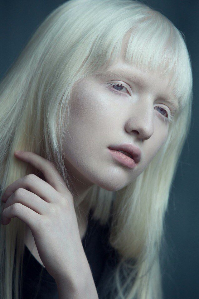 жена альбинос. алена михайлова. жена альбинос. жена альбинос. анок уай.