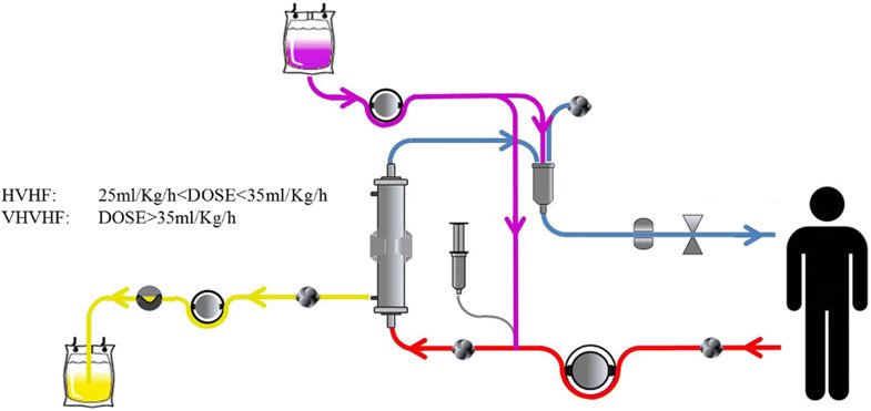 Extracorporeal techniques for the treatment of critically ill patients with sepsis beyond conventional blood purification therapy: the promises and the pitfalls
#FOAMed
bit.ly/2JmNNBK