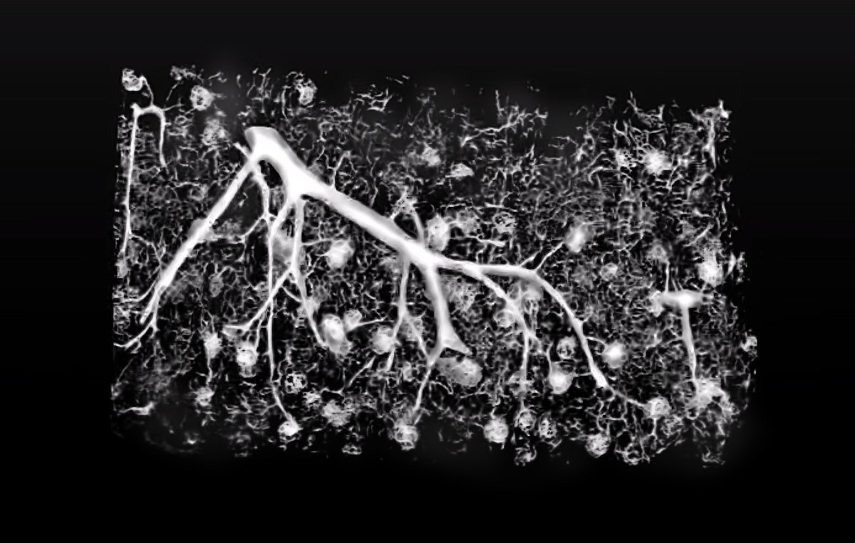 3ScanTweets's tweet photo. https://t.co/LSdzRH7KWz #NIH #SBIR #imaging #kidney #discovery
#biotechnology #3d https://t.co/QzzQzZvcg3