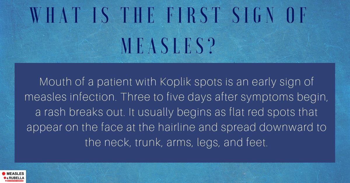 dhsfwassam's tweet photo. Sign of a measles infection . https://t.co/s1IGjg4dHw