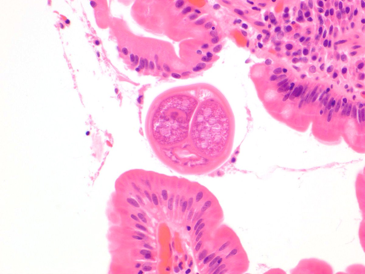 jocumiskey's tweet image. This is all I get before it cuts out :(