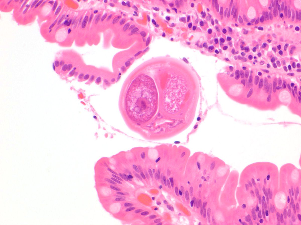 jocumiskey's tweet image. This is all I get before it cuts out :(