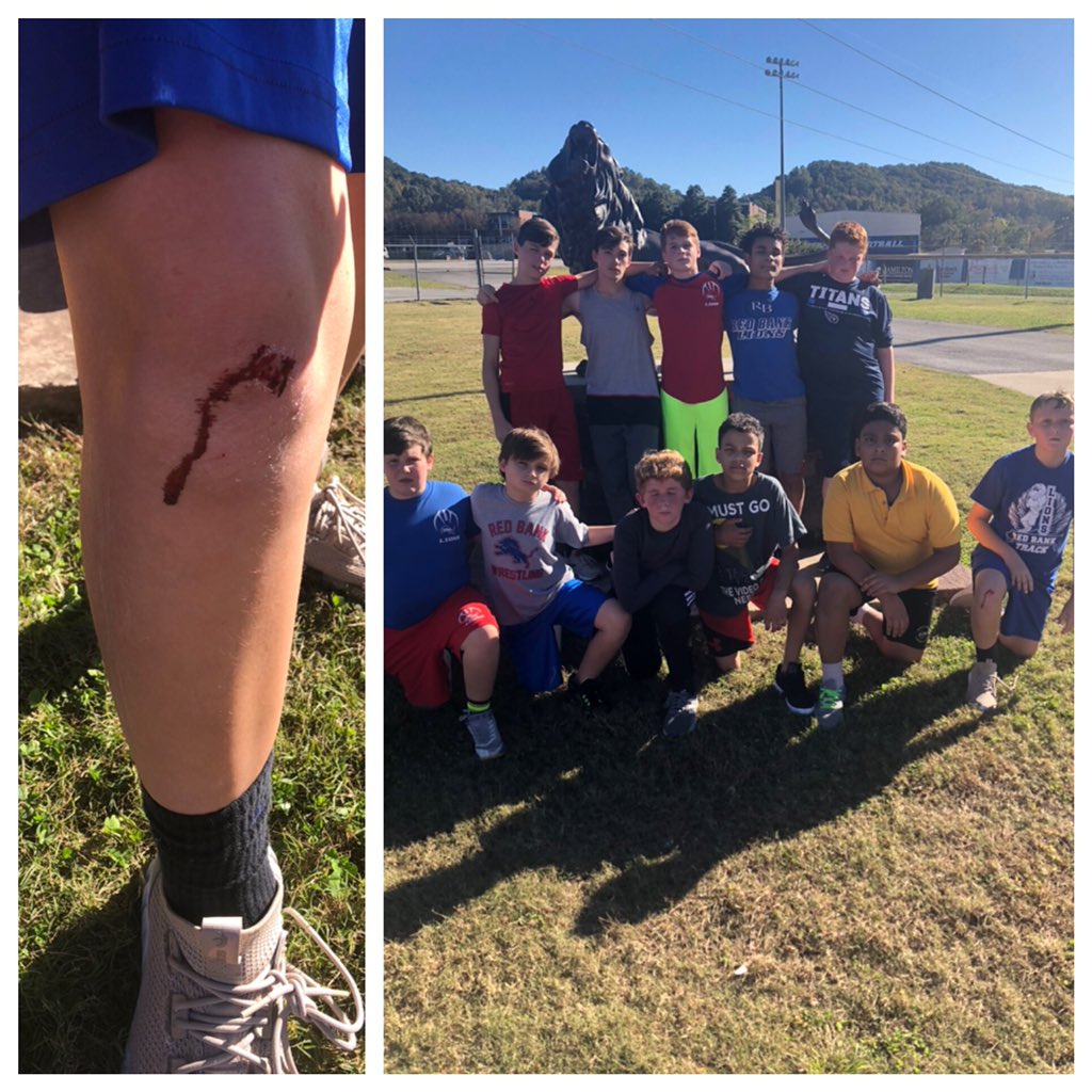 gwilson7004's tweet photo. A little battle scar, a lot of hard work, and never ending toughness = Red Bank Athletes. Proud of these young men at conditioning today! #rbway #stepright @RBHS_Lions https://t.co/krDhEqAUaR