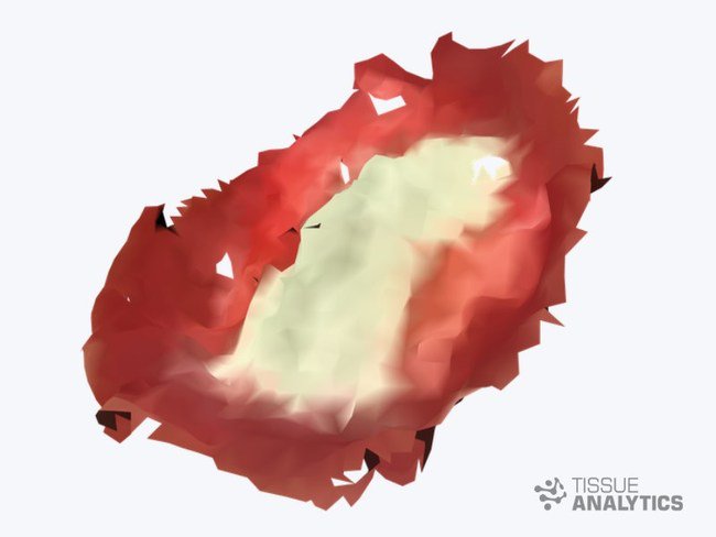 Wound Care Advantage (@wcadvantage) on Twitter photo WCA Partners with Tissue Analytics, combining nearly 17 years of clinical data with AI and 3D imaging for improved patient outcomes tinyurl.com/ycfqbbfy <a href="/WCAdvantage/">Wound Care Advantage</a> <a href="/TissueAnalytics/">Tissue Analytics</a> #woundcare #AI #3D WCA Partners with Tissue Analytics, combining nearly 17 years of clinical data with AI and 3D imaging for improved patient outcomes tinyurl.com/ycfqbbfy <a href="/WCAdvantage/">Wound Care Advantage</a> <a href="/TissueAnalytics/">Tissue Analytics</a> #woundcare #AI #3D