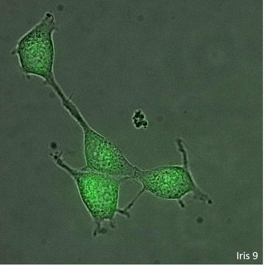 Photometrics's tweet image. Great day making some mouse hippocampal neurons very happy, reducing their light dose significantly with a new camera. That's what we like to see!