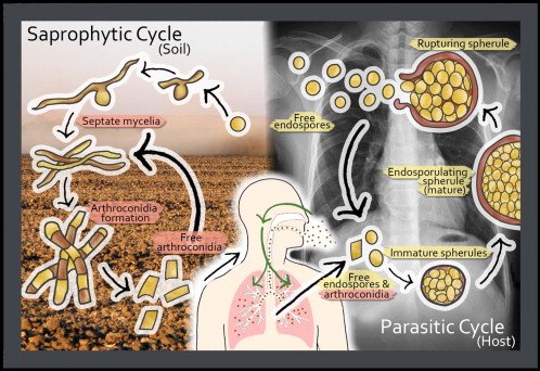 MicrobesInfect's tweet image. #ValleyFever : danger lurking in a dust cloud.

On lung infections by the soil-borne fungal pathogen #Coccidioides

sciencedirect.com/science/articl…