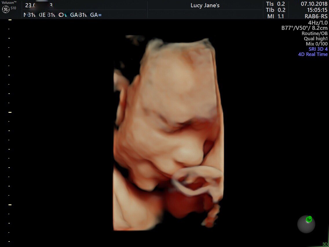 ljpregnancyco's tweet photo. And suddenly you were my everything💞 #LucyJanes #ultrasound #ultrasoundclinic #scanclinic #babyscans #babyscanclinic #pregnancy #antenatal #mumtobe #baby #newborn #boyorgirl #babyboy #babygirl https://t.co/ylbOkqyE3Z