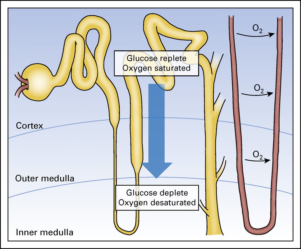 Cecilia_Lobato_'s tweet image. #hilo
El cáncer renal, es una enfermedad METABÓLICA.
Las principales fuentes de efecto metabólico en los tumores renales:
-alteraciones de la regulación de la glucosa y la glucólisis
-factores que alimentan la carboxilación reductiva
-defectos mitocondriales (transporte e−)