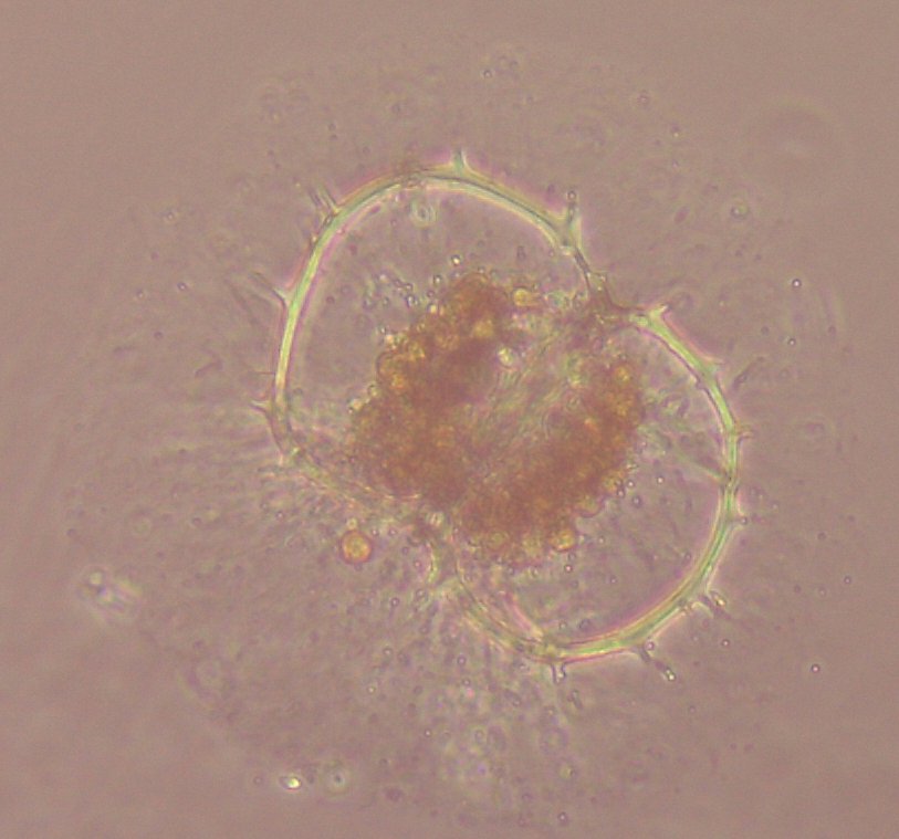 MargaretBrisbin's tweet photo. A #TinyPrettyTuesday pick me up. Even if things are not great, you can look down a microscope at a water drop &amp; see #tinypretty wonders like this Acanthodesmia #radiolarian. Haeckel called this one Eucoronis-true flourish. It has flair, &amp; beautiful #symbionts! #plankton #protists https://t.co/M8hHAWukf5