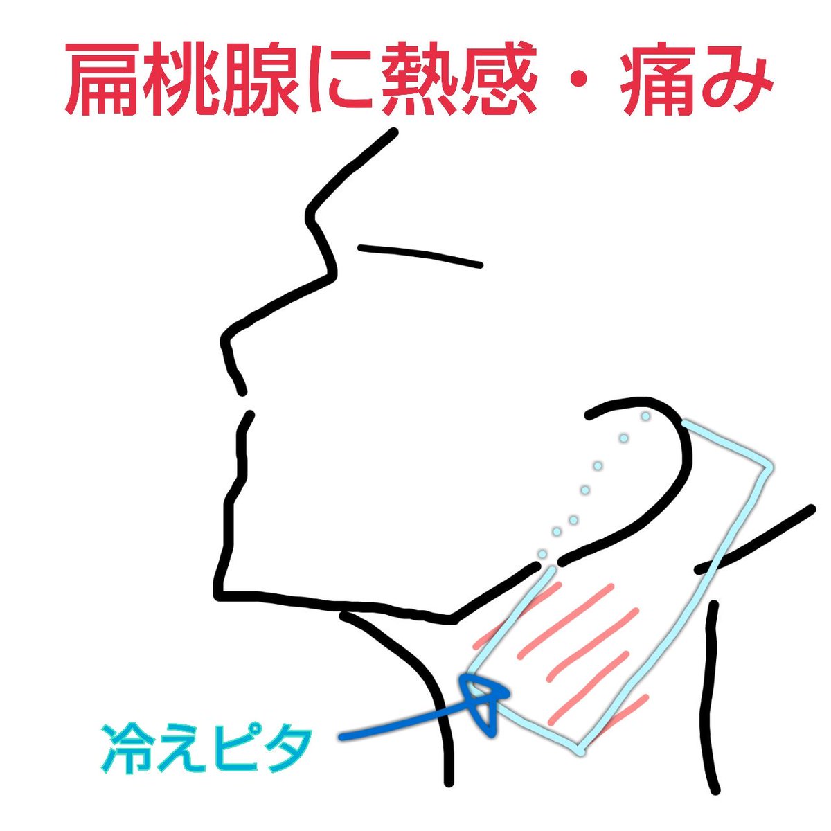 凹ºぺん ぽこぺん 今回の風邪は頭痛のする発熱風邪 私もあまりの痛さに唸ったし我慢ならずに冷えピタ貼りまくってたなぁ 額と鼻と首の両側に貼ってなんとか耐えたし 首の冷えピタが剥がれやすかったから 締めつけの弱いヘアバンドを顎から頭に