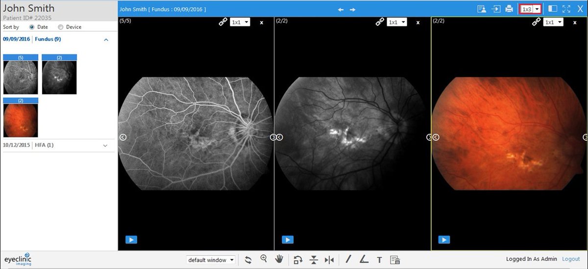 First_Insight's tweet image. It&apos;s our last day at #AAO2018. Spend less time searching for patient images and reports from #imagingdevices with EyeClinic Imaging. Works with any #ophthalmic #EHR. @aao_ophth Booth 2103. View video: bit.ly/2oeXqGY

#ophthalmology #imagemanagement