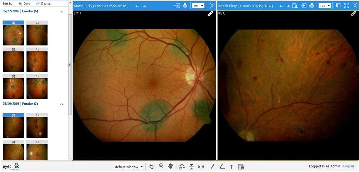 First_Insight's tweet image. It&apos;s our last day at #AAO2018. Spend less time searching for patient images and reports from #imagingdevices with EyeClinic Imaging. Works with any #ophthalmic #EHR. @aao_ophth Booth 2103. View video: bit.ly/2oeXqGY

#ophthalmology #imagemanagement