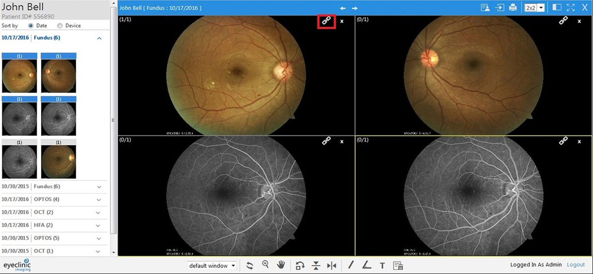 First_Insight's tweet image. It&apos;s our last day at #AAO2018. Spend less time searching for patient images and reports from #imagingdevices with EyeClinic Imaging. Works with any #ophthalmic #EHR. @aao_ophth Booth 2103. View video: bit.ly/2oeXqGY

#ophthalmology #imagemanagement