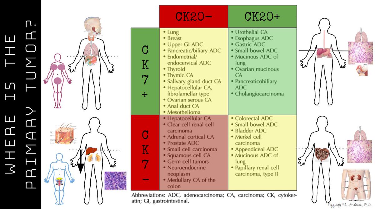 how do you treat chronic obstructive pulmonary disorder