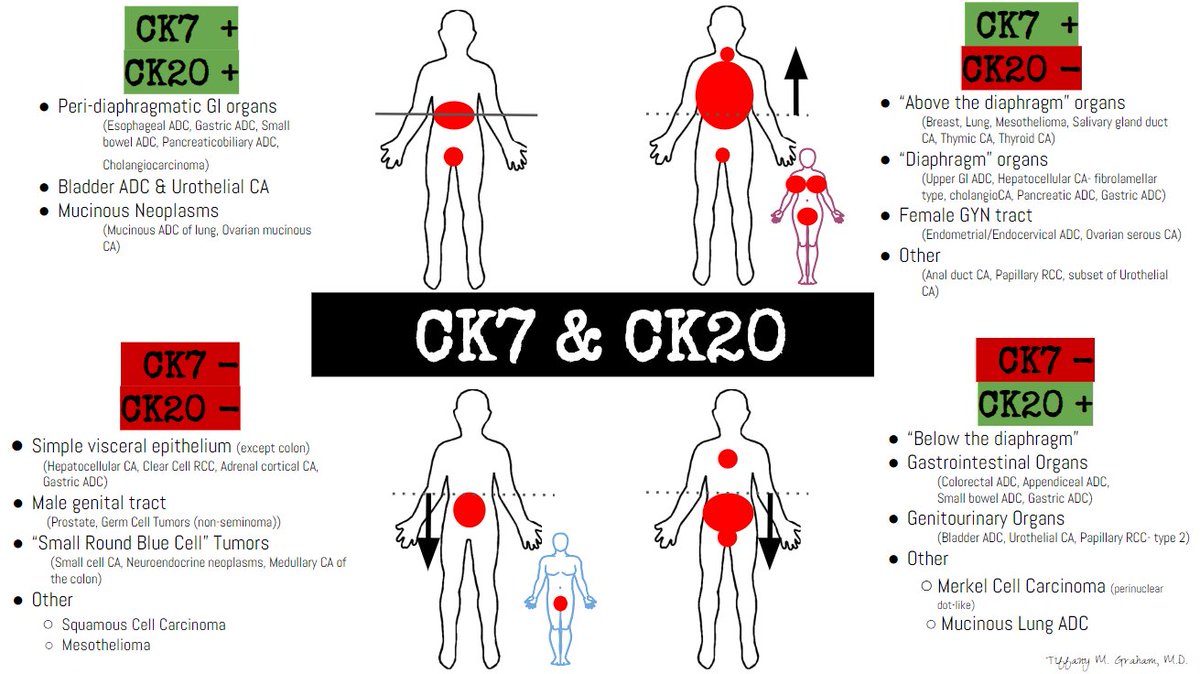 how long does stage 3 copd last