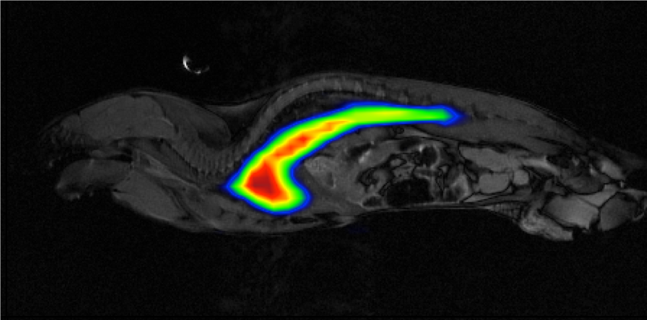Finalistenprojekt für den Norddeutschen Wissenschaftspreis 2018!
Magnetic Particle Imaging: Eine strahlungsfreie Alternative
für die zukünftige Gefäßdarstellung
Ein Projekt von <a href="/unihh/">Universität Hamburg</a> und <a href="/UniLuebeck/">Universität Lübeck</a>