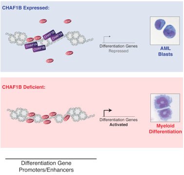 Cancer_Cell's tweet image. Crispino @NorthwesternU &amp;amp; colleagues reveal that CHAF1B promotes leukemogenesis by binding chromatin to interfere with myeloid differentiation, and targeted disruption of CHAF1B might provide a differentiation-driving strategy for leukemia. cell.com/cancer-cell/fu…