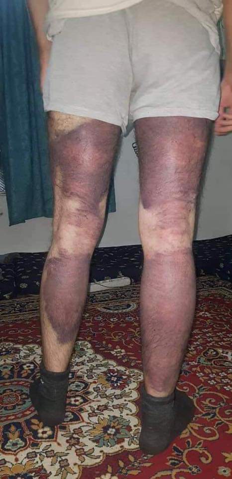 Mazen Hassoun tweet media