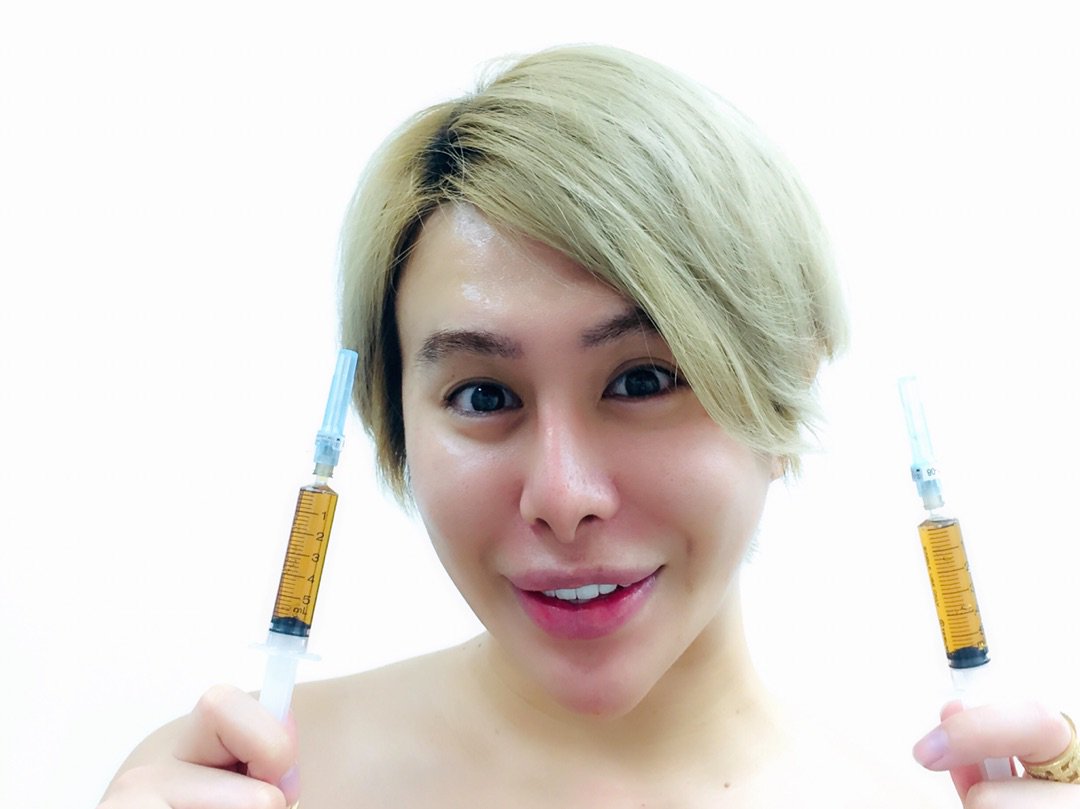 ᗩᒪᒪᕮɲ アレン アレンはプラセンタ中毒 ではないですよ ー アメブロを更新しました アレン プラセンタ注射 T Co Z5j84mossj