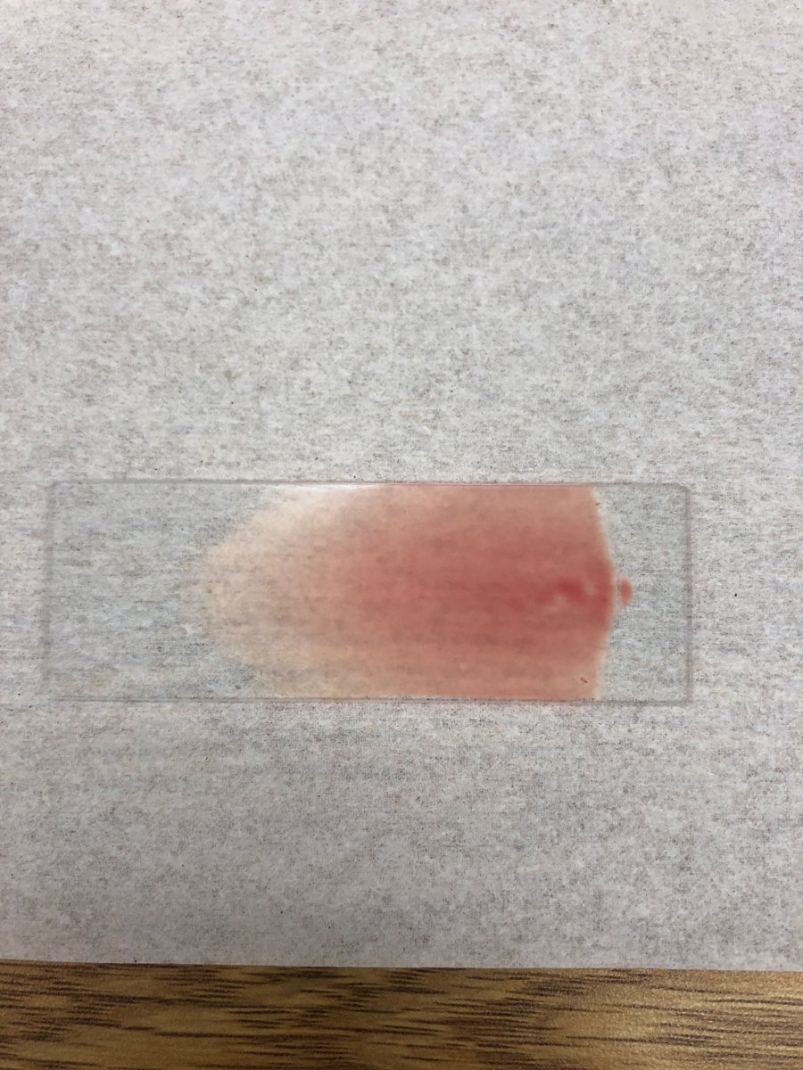 DomAllie's tweet image. My blood smear (the most perfect one I’ve ever made) from earlier had two neutrophils with today’s date 🤗 11/12 #techbae