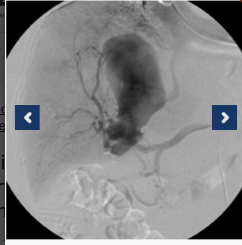 AWright (Blue) tweet media