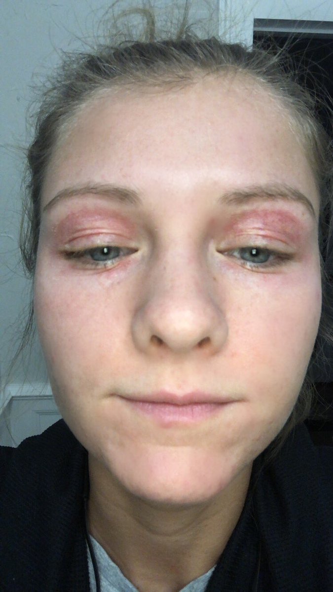 anti aging for 20 year olds