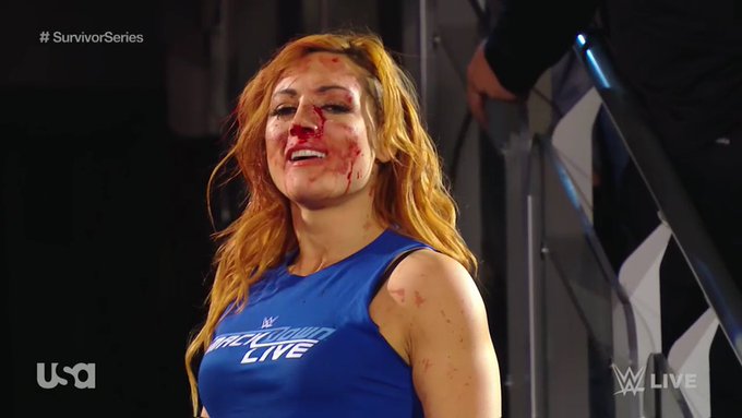 Becky Lynch Bloody