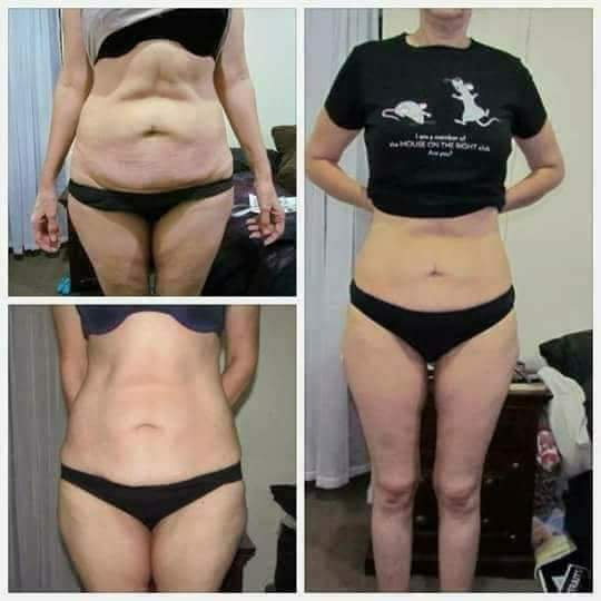 No invasivo 100% recomendado