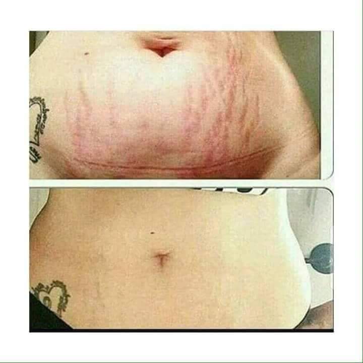 Increíbles resultados😍😍