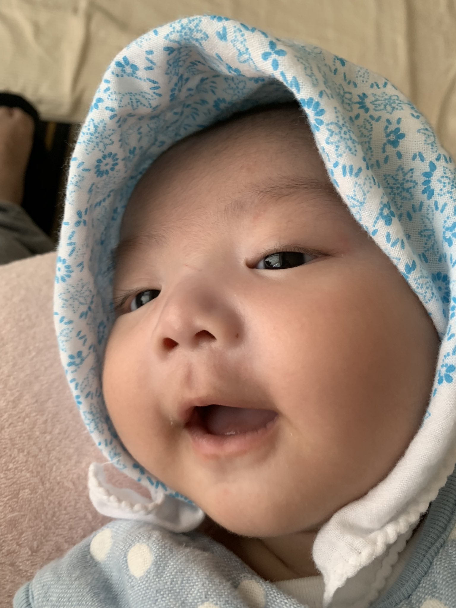 乳児脂漏性湿疹 Cerca Del Twitter Twitter