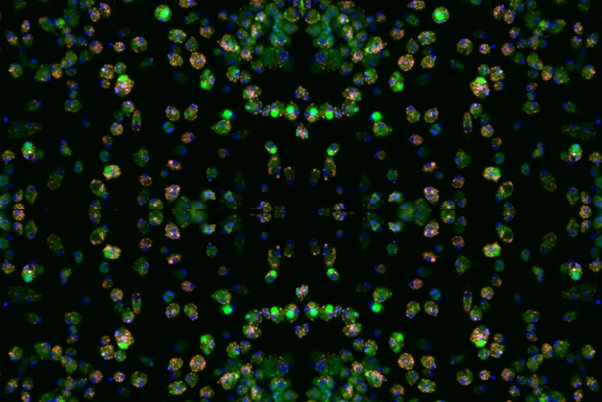 November is #COPD Awareness Month. Censo bio has recently announced funding to research into this terrible disease. COPD is a progressive lung disease that the #WHO anticipates to be third largest cause of death by 2030. Read more here buff.ly/2PF4CNR #drugdiscovery #iPSC