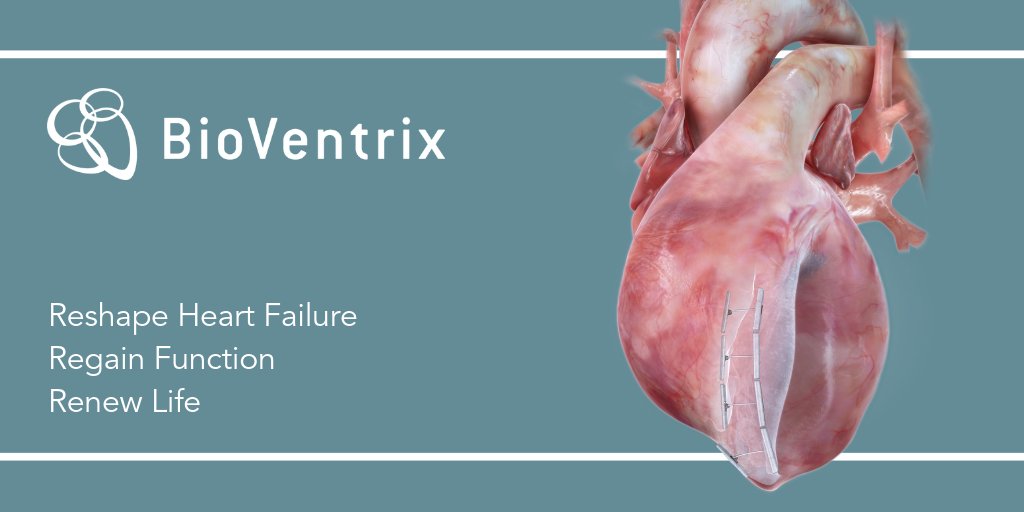 BioVentrixDE's tweet photo. Besuchen Sie uns auf https://t.co/mhepJMZjYK, um mehr darüber zu erfahren, wie wir mit unserem Less Invasive Ventricular Enhancement Verfahren die #Herzinsuffizienz umformen. https://t.co/kgwMq533tf