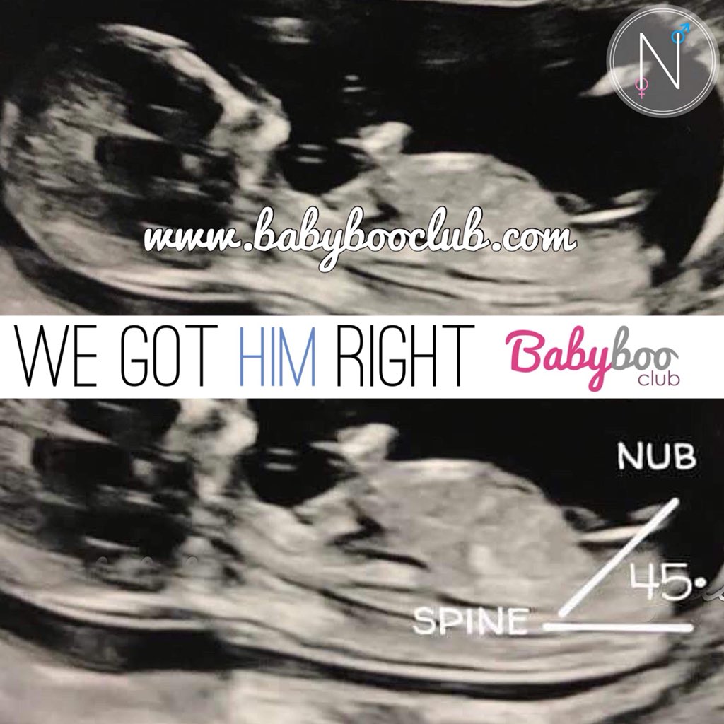 BabyBooClub's tweet photo. We got him right! #genderprediction #nubologists #nubtheory #expecting #nubexperts #baby #pregnancy #12weekscan #duein2019 #nub #babybump #babyscan #boynub #pinkorblue #girlorboy email your 12+week scan pictures to >> info@babybooclub.com 🤰🏻👶🏻 https://t.co/5lS2cZ0FNl