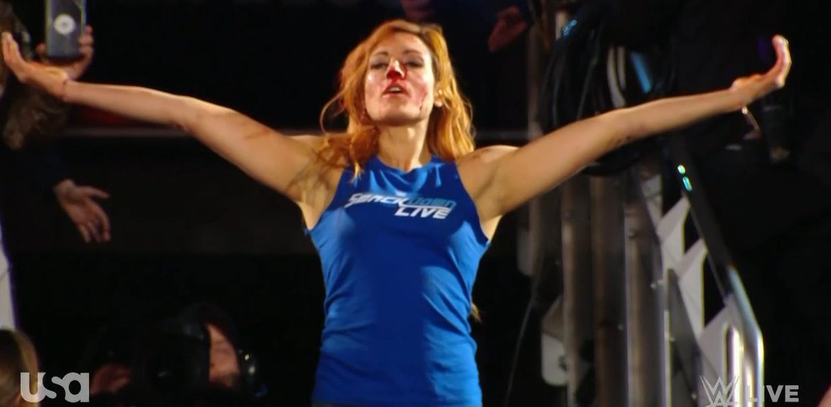thepeachy16's tweet photo. #TotalBadassTuesday Beautiful Awesome The Main Event @BeckyLynchWWE #LassKicker #BeckyBalboa #TheChamp #TheMan https://t.co/fsRxVu82kJ