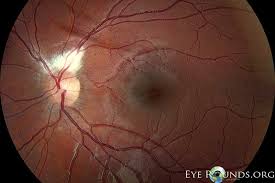 2019Eye's tweet photo. Find More Information about Eyes@ https://t.co/tcteCR48OT
An eye is composed of more than two million working parts including over one million nerve fibres which connect each eye to the brain.
#Retina #OphthalmologyDisorders #OcularPharmacology #OcularImmunology #EyeConditions https://t.co/7M8fWY5y6M